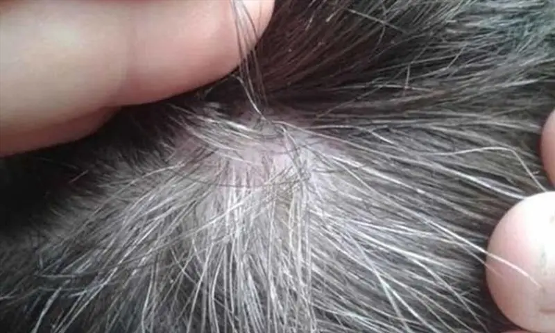 mơ thấy tóc bạc