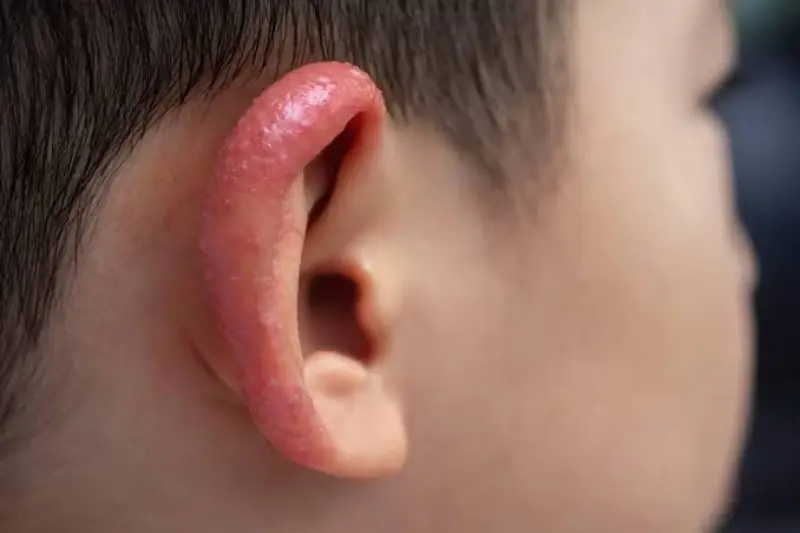 Bị nóng ngứa tai là điềm gì theo quan niệm dân gian?