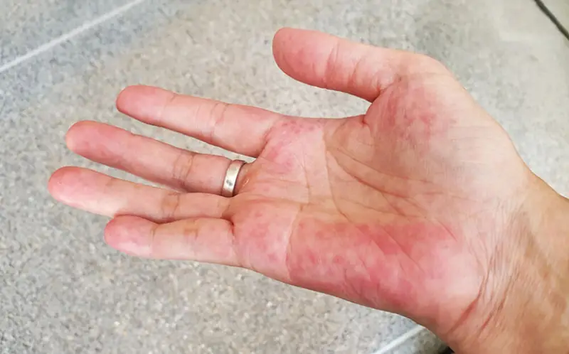 Ngứa lòng bàn tay trái theo từng khung giờ có ý nghĩa gì?