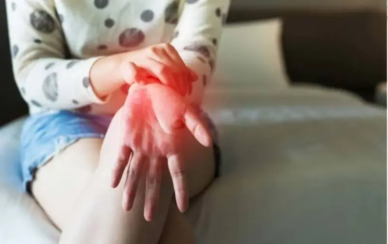 Nguyên nhân ngứa lòng bàn tay trái