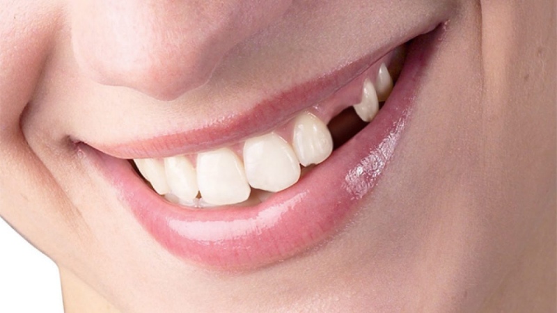 Nằm mơ thấy rụng răng đánh con mấy bao ăn?