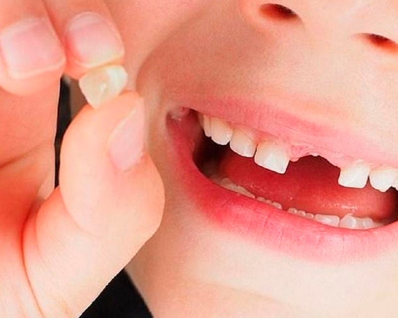 Nằm mơ thấy rụng răng là điềm gì? Giải mã điềm báo rụng răng