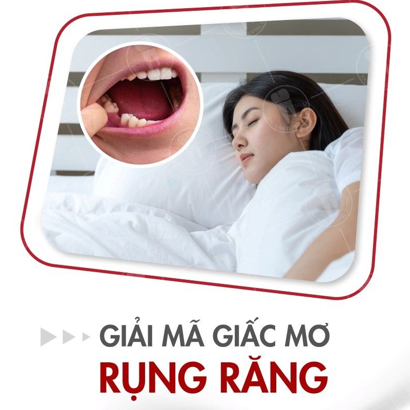 Nằm mơ thấy rụng răng là điềm gì? Giải mã điềm báo rụng răng